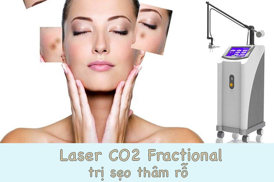 Trẻ Hóa Da Bằng Laser CO2 Có Tốt Không Giải Pháp Hiệu Quả Cho Làn Da Thanh Xuân (2)